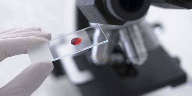 análise de sangue para diagnosticar parasitos no corpo